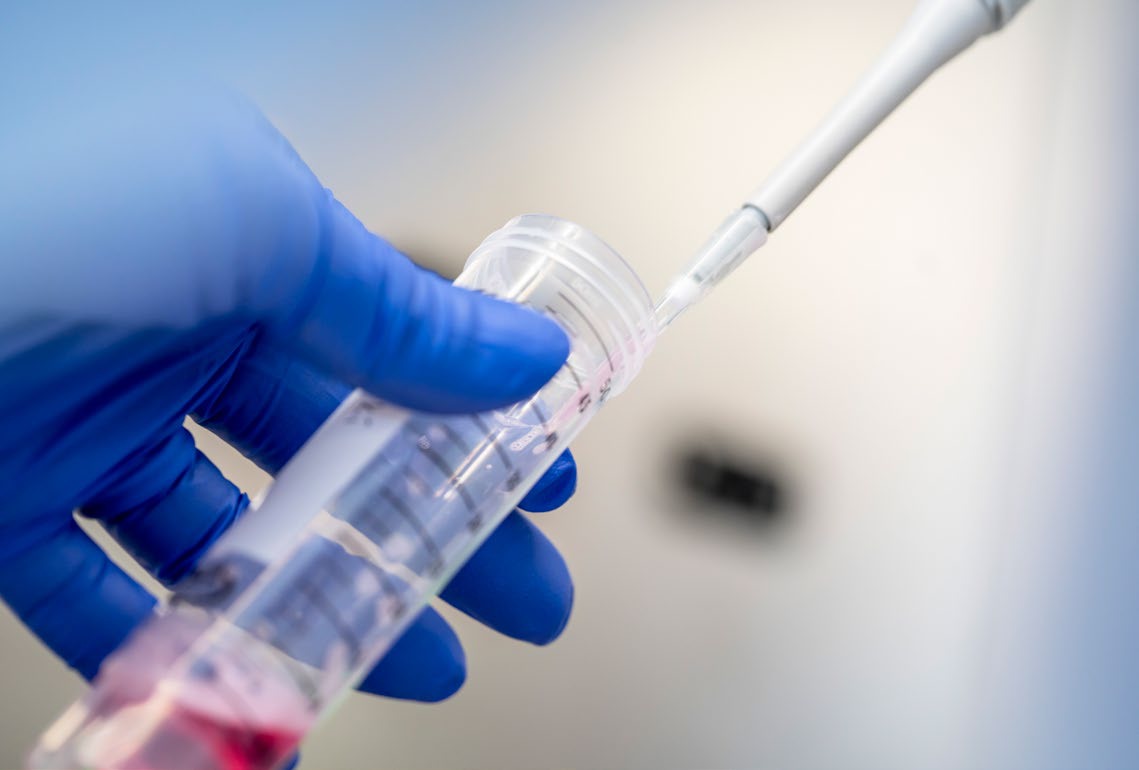 Laboratoriumonderzoek met pipet en reageerbuis